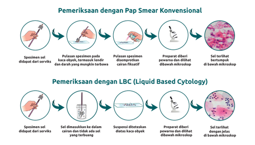 Alternatif Pemeriksaan Hpv Dna